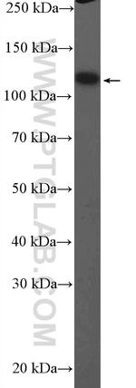 ITIH4 Antibody in Western Blot (WB)