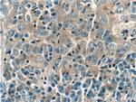 ANKLE1 Antibody in Immunohistochemistry (Paraffin) (IHC (P))