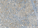 ANKLE1 Antibody in Immunohistochemistry (Paraffin) (IHC (P))