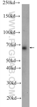 ANKLE1 Antibody in Western Blot (WB)