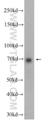 ANKLE1 Antibody in Western Blot (WB)
