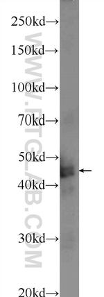 TMEM201 Antibody in Western Blot (WB)