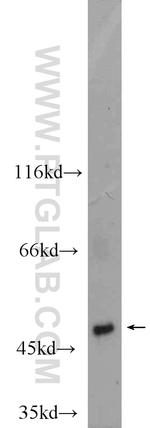 NT5DC1 Antibody in Western Blot (WB)