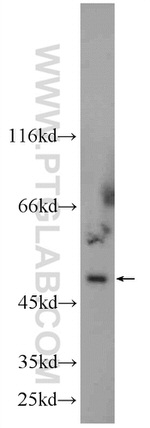 NT5DC1 Antibody in Western Blot (WB)