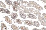 PCGF6 Antibody in Immunohistochemistry (Paraffin) (IHC (P))