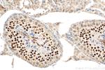 PCGF6 Antibody in Immunohistochemistry (Paraffin) (IHC (P))