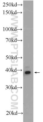 PCGF6 Antibody in Western Blot (WB)