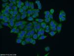 HACE1 Antibody in Immunocytochemistry (ICC/IF)