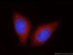 SIL1 Antibody in Immunocytochemistry (ICC/IF)