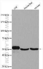 SIL1 Antibody in Western Blot (WB)