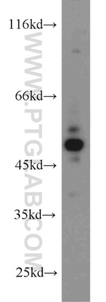 SIL1 Antibody in Western Blot (WB)