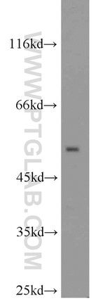 SIL1 Antibody in Western Blot (WB)
