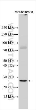 ZMYM2 Antibody in Western Blot (WB)