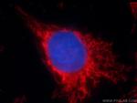 SOD2 Antibody in Immunocytochemistry (ICC/IF)
