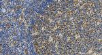 CD320 Antibody in Immunohistochemistry (Paraffin) (IHC (P))