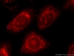 ATF6 Antibody in Immunocytochemistry (ICC/IF)