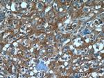 ATF6 Antibody in Immunohistochemistry (Paraffin) (IHC (P))