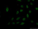 PREX2 Antibody in Immunocytochemistry (ICC/IF)