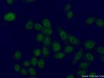 LUC7L2 Antibody in Immunocytochemistry (ICC/IF)