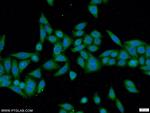 ANKRD55 Antibody in Immunocytochemistry (ICC/IF)