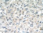 ANKRD55 Antibody in Immunohistochemistry (Paraffin) (IHC (P))