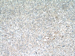 ANKRD55 Antibody in Immunohistochemistry (Paraffin) (IHC (P))