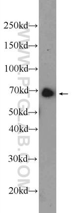 ANKRD55 Antibody in Western Blot (WB)