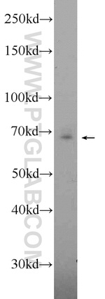 ANKRD55 Antibody in Western Blot (WB)