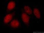 DNMT1 Antibody in Immunocytochemistry (ICC/IF)