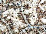 DNMT1 Antibody in Immunohistochemistry (Paraffin) (IHC (P))
