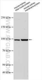 TMEM63B Antibody in Western Blot (WB)