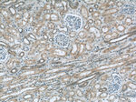 TAF15 Antibody in Immunohistochemistry (Paraffin) (IHC (P))