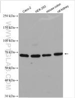 Frizzled 2 Antibody in Western Blot (WB)