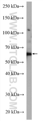 Frizzled 2 Antibody in Western Blot (WB)