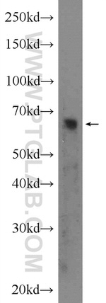 Frizzled 2 Antibody in Western Blot (WB)