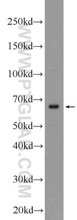 Frizzled 2 Antibody in Western Blot (WB)