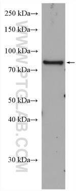PTH1R Antibody in Western Blot (WB)
