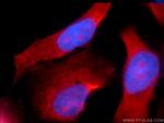 CCDC104 Antibody in Immunocytochemistry (ICC/IF)