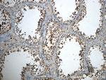 CCDC104 Antibody in Immunohistochemistry (Paraffin) (IHC (P))
