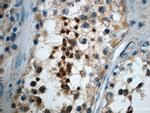 CCDC104 Antibody in Immunohistochemistry (Paraffin) (IHC (P))