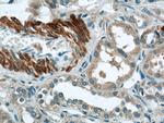 FBXO28 Antibody in Immunohistochemistry (Paraffin) (IHC (P))