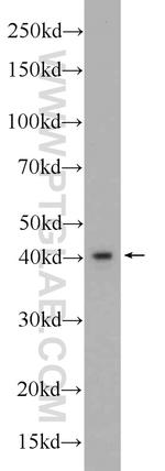 FBXO28 Antibody in Western Blot (WB)
