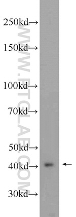 FBXO28 Antibody in Western Blot (WB)
