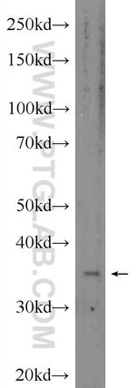 FOXB1 Antibody in Western Blot (WB)