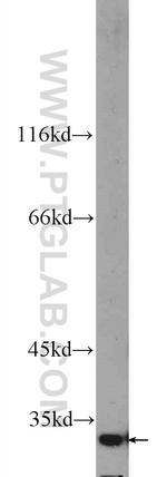 FOXB1 Antibody in Western Blot (WB)