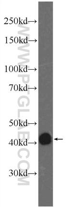 FAM71F2 Antibody in Western Blot (WB)