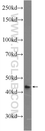 FAM71F2 Antibody in Western Blot (WB)