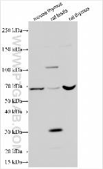 MIF4GD Antibody in Western Blot (WB)