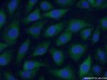 F2 Antibody in Immunocytochemistry (ICC/IF)