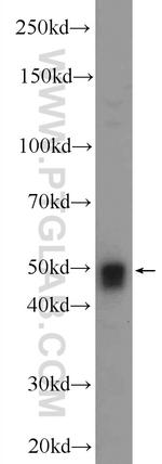 SNRNP48 Antibody in Western Blot (WB)
